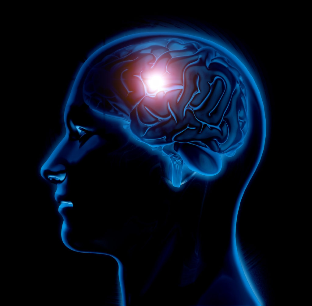 ¿Qué es el Neuromarketing? Neuromarketing en tu Clínica Veterinaria